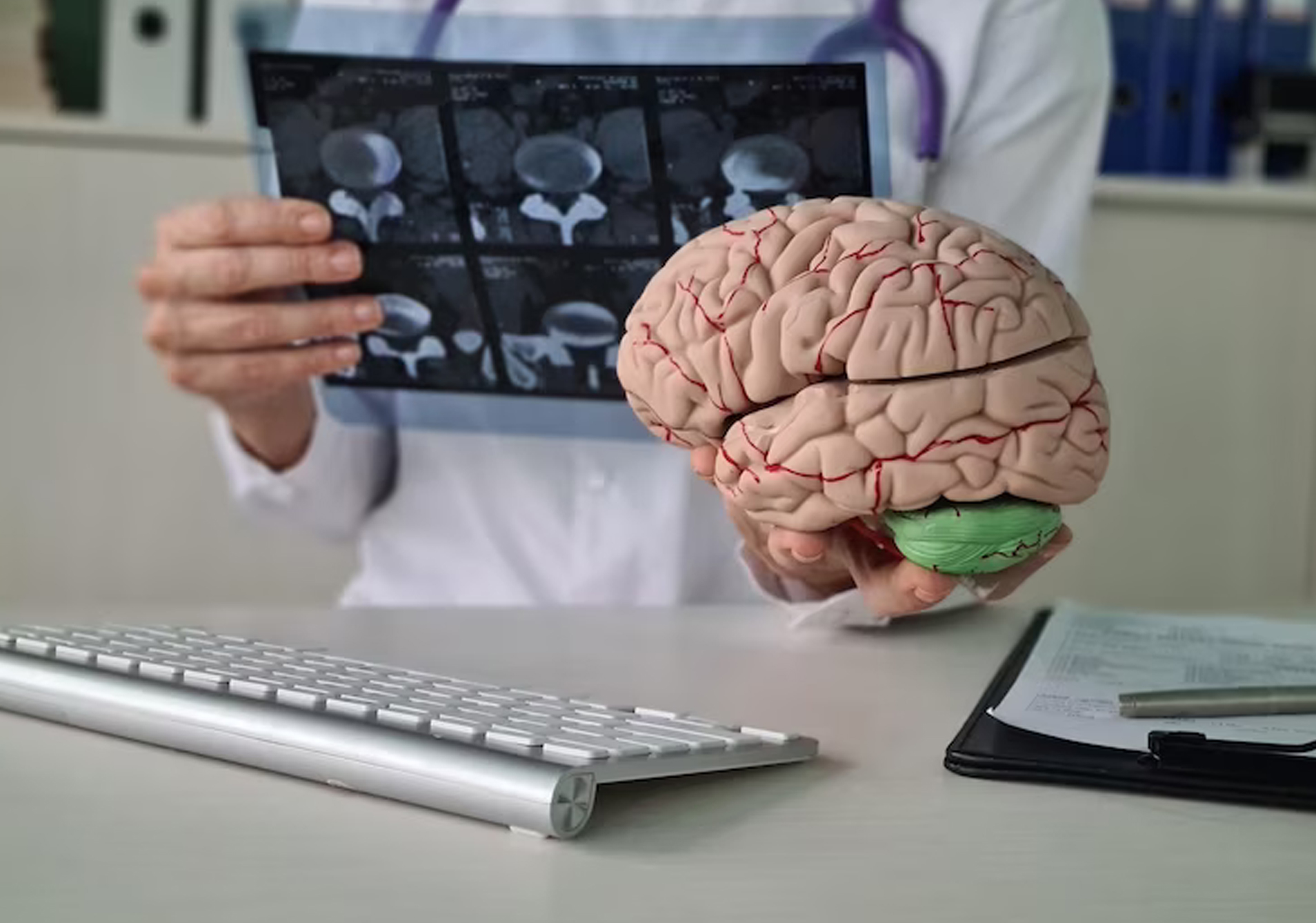 Brain Tumour